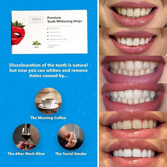 Whites Beaconsfield Teeth Whitening Strips - Advanced Non-Peroxide Formula, 28 Strips (14-Day Treatment) for Enhanced Brightness, Enamel-Safe, Gentle on Sensitive Teeth, Quick & Visible Results