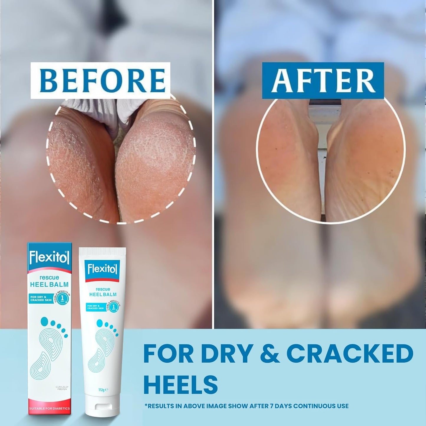 Flexitol Rescue Heel Balm - Foot Cream for Visible Results in 1 Day - For Cracked Heels and Very Dry Feet - 25 Percent Urea for Intense Hydration - Clinically Proven - Suitable for Diabetics - 112g