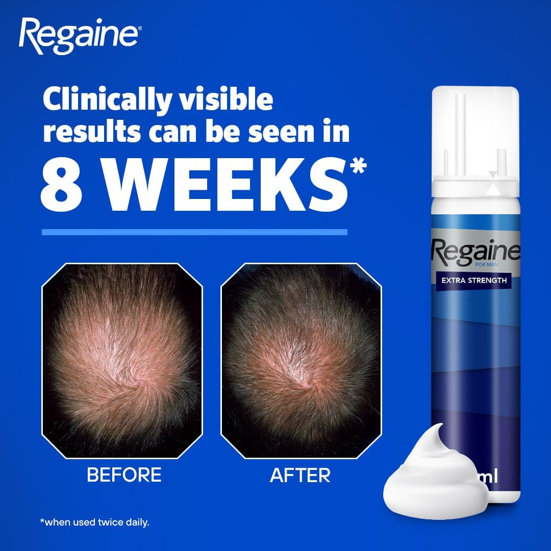 Regaine Extra Strength Scalp Cutaneous Foam (3x 73 ml), Treatment for Regrowth in Men with 5% Minoxidil, for Male Hair Loss