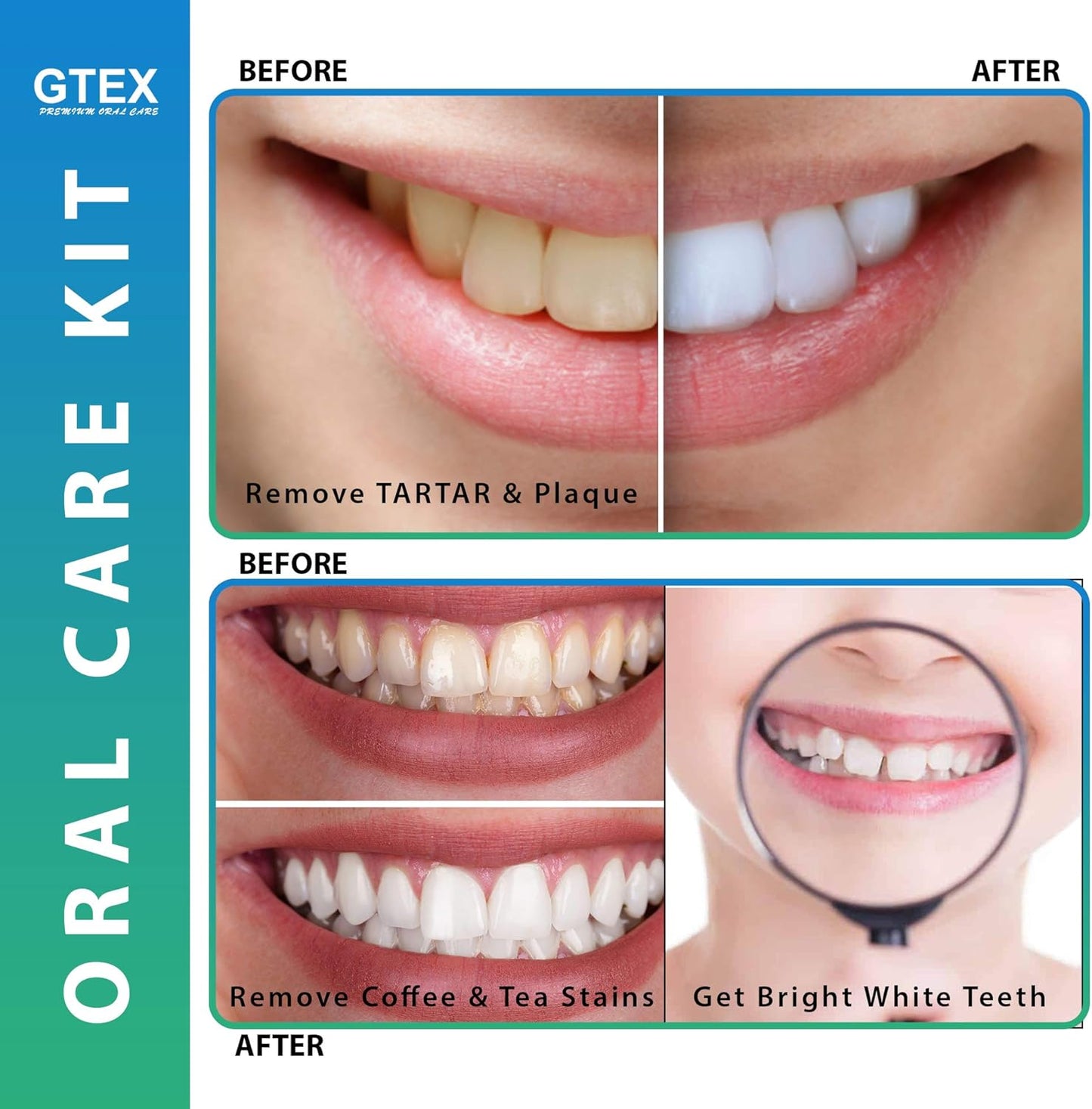 GTEX Plaque Remover for Teeth, 5PC Dental Tools Kit for Teeth Cleaning Plaque Removal, Tartar Remover for Teeth Dental Plaque Removal Tool Dental Mirror Teeth Cleaning Kit for Home Use