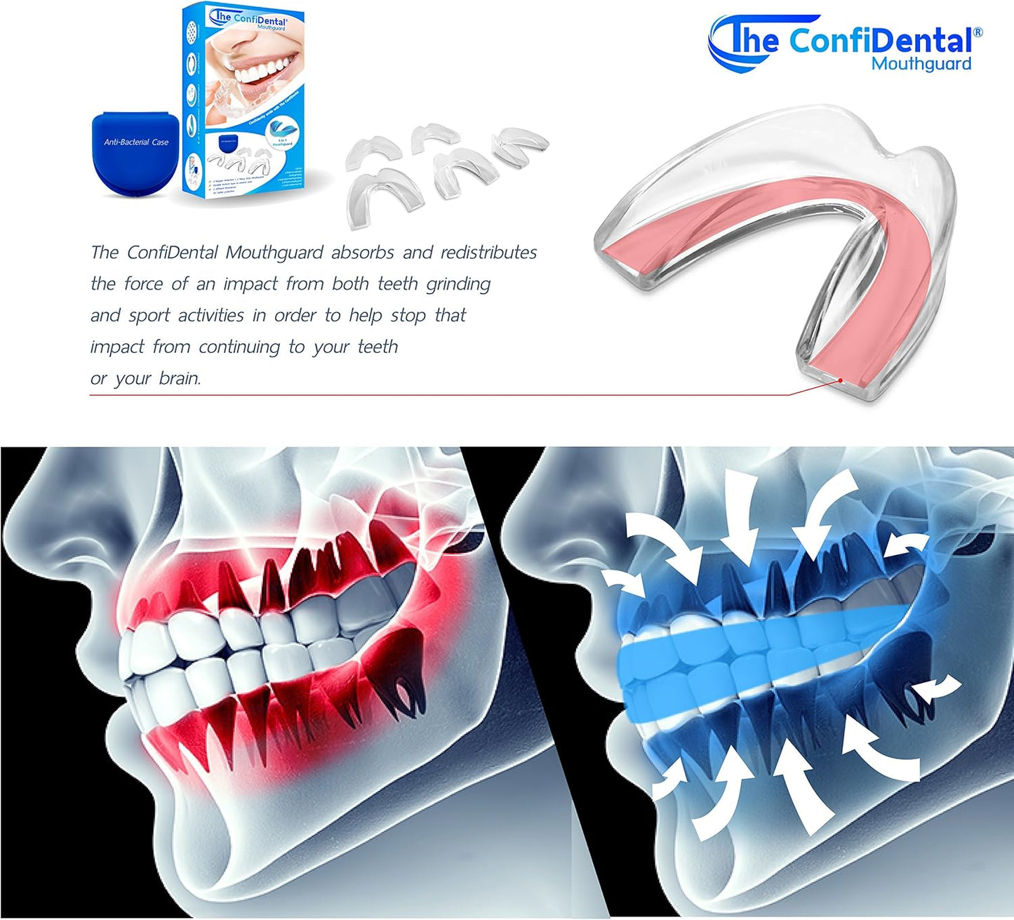The Confidental - Pack Of 5 Moldable Mouth Guard For Teeth Grinding Clenching Bruxism, Sport Athletic, Whitening Tray, Including 3 Regular And 2 Heavy Duty Guard (3 (Lll) Regular 2 (Ii) Heavy Duty)